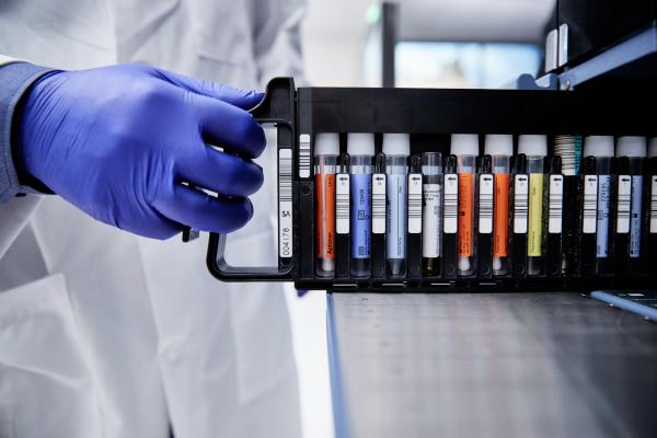 PCR tests in a rack held by a hand wearing gloves.