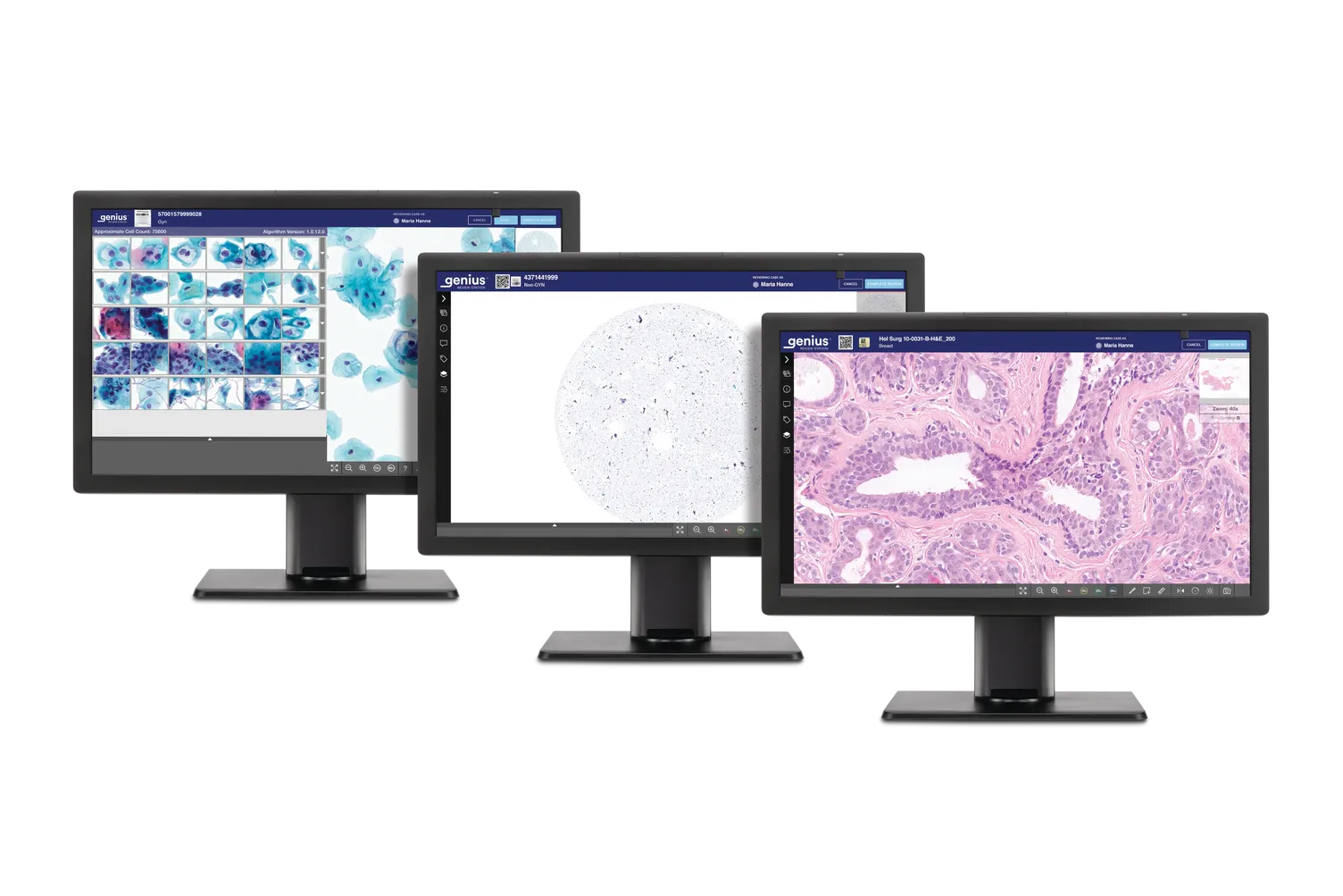 3 Genius monitors showing histology and cytology scans ready for review.
