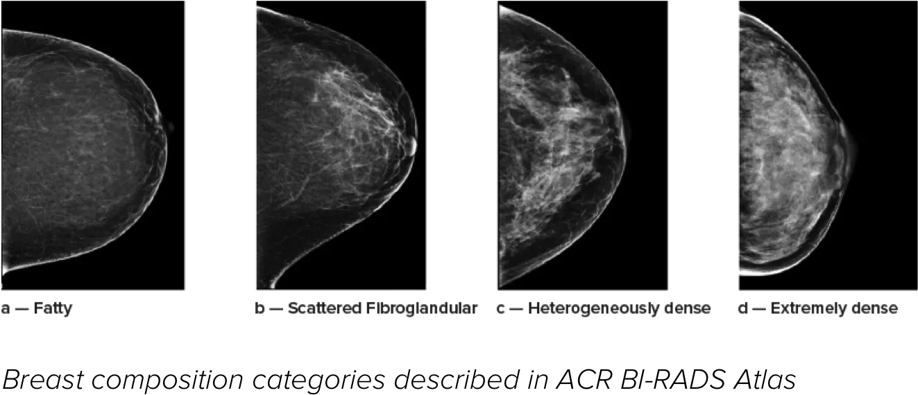 Breast imaging scans