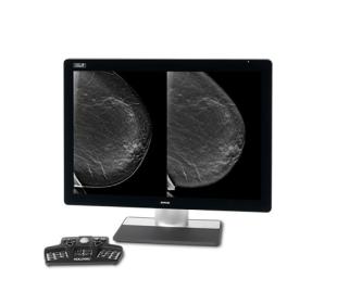 Hologic Intelligent 2D™ Synthesised Imaging in white background