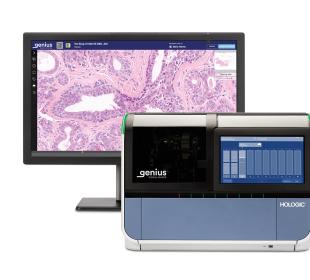 Genius Digital Diagnostics Imager and monitor being used for pathology analysis